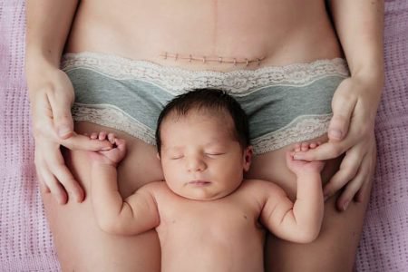 Poród przez cesarskie cięcie - jakie są zagrożenia?