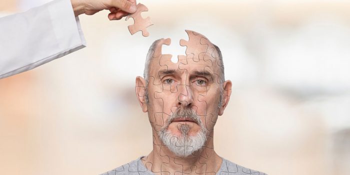 Choroba Alzheimera