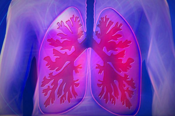 Przewlekła obturacyjna choroba płuc (P0ChP)