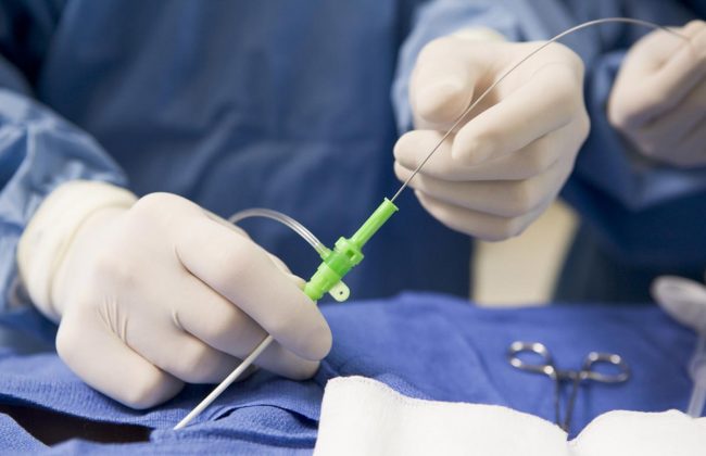 Angiografia