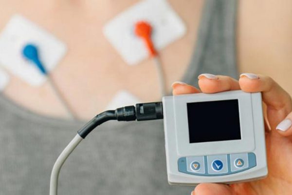 24-godzinna rejestracja metodą Holtera (EKG)
