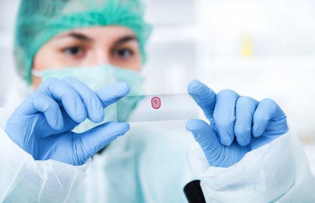 Biopsja