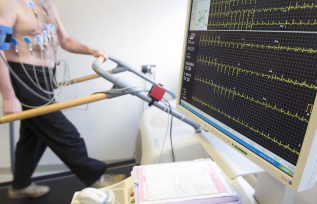 EKG wysiłkowe (Próba wysiłkowa)