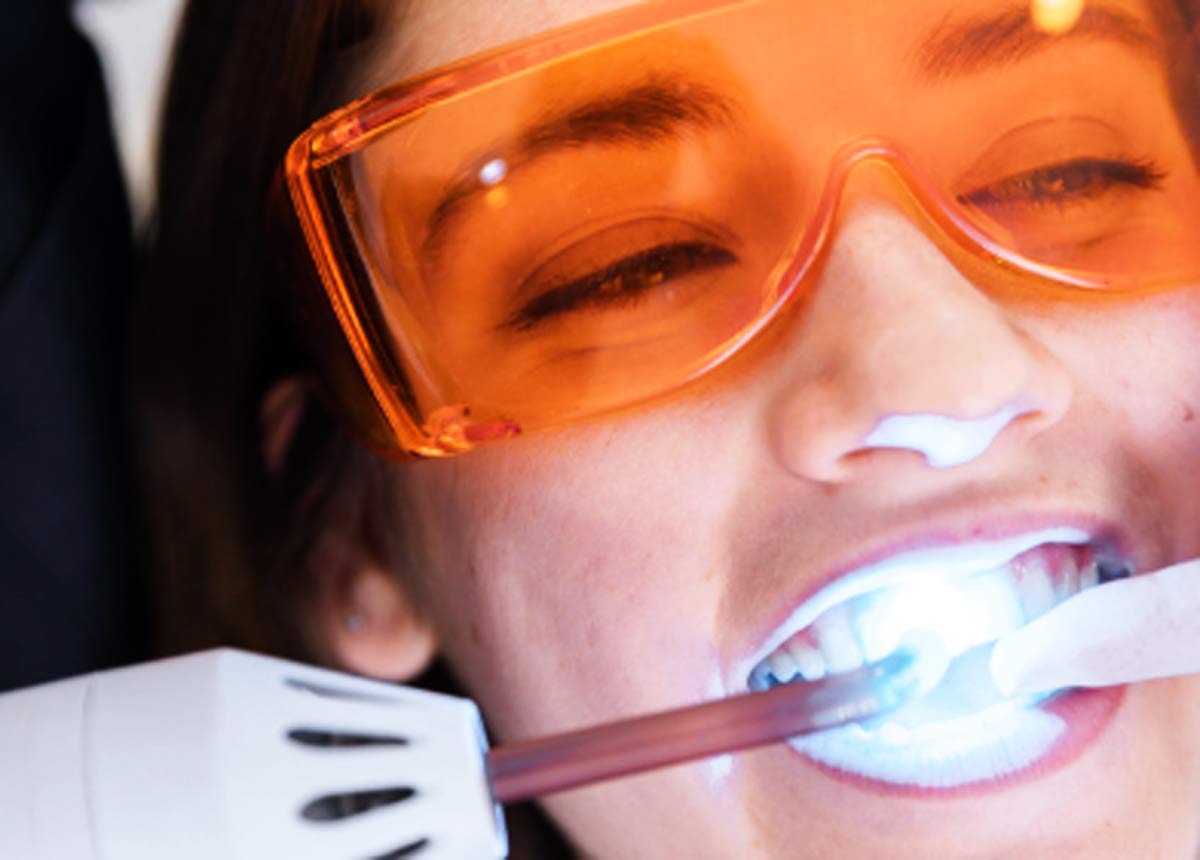 Jakie zabiegi estetyczne może wykonać stomatolog?