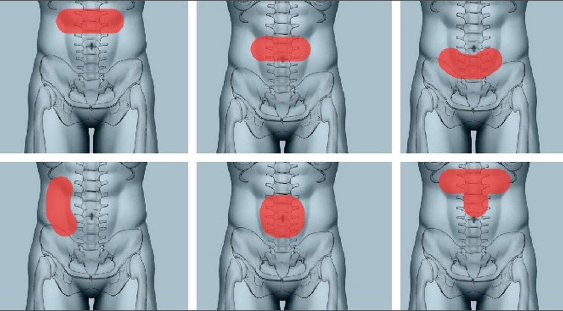 Jak zlokalizować ból brzucha