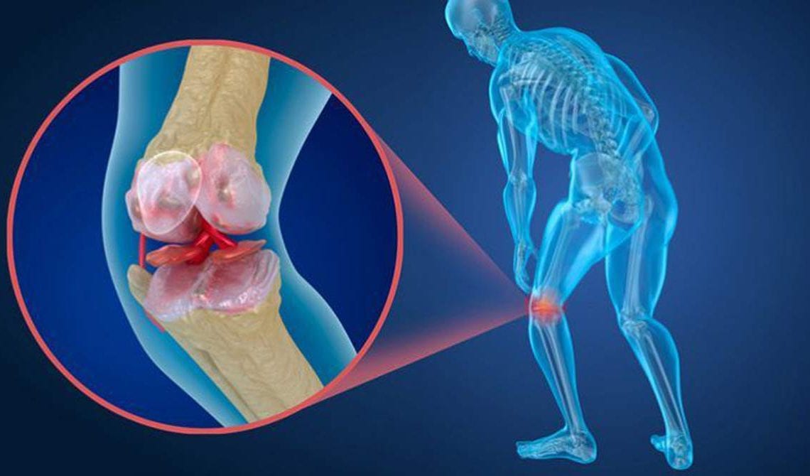 bóle stawów, kolan oraz pleców