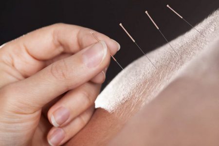 Medycyna chińska - akupresura, akupunktura