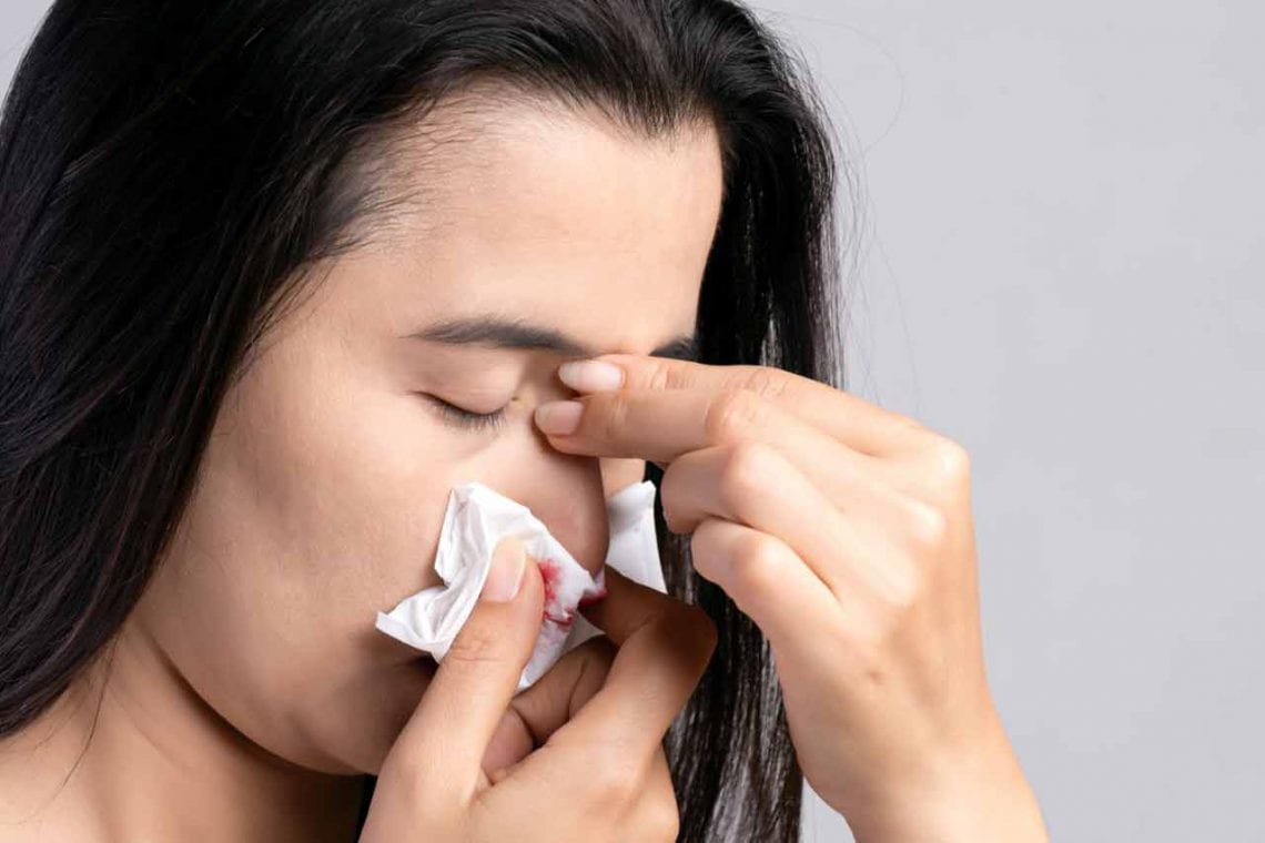 Jak zatrzymać krwotok z nosa?